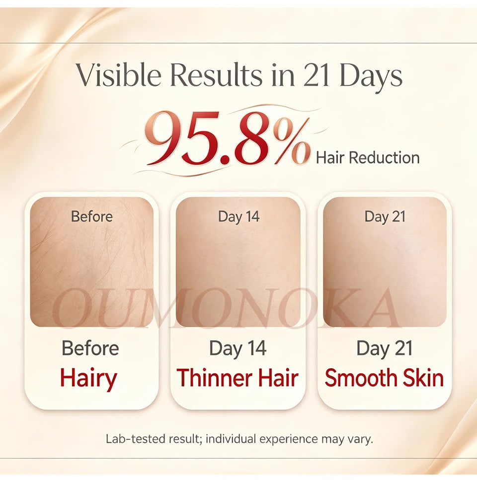 IPL Laser Hair Removal Device – Permanent At-Home Epilator for Face, Body & Bikini | All Skin Tones